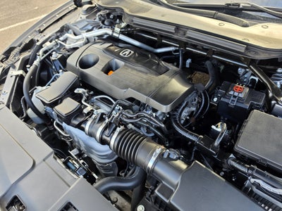 2025 Acura TLX Technology Package